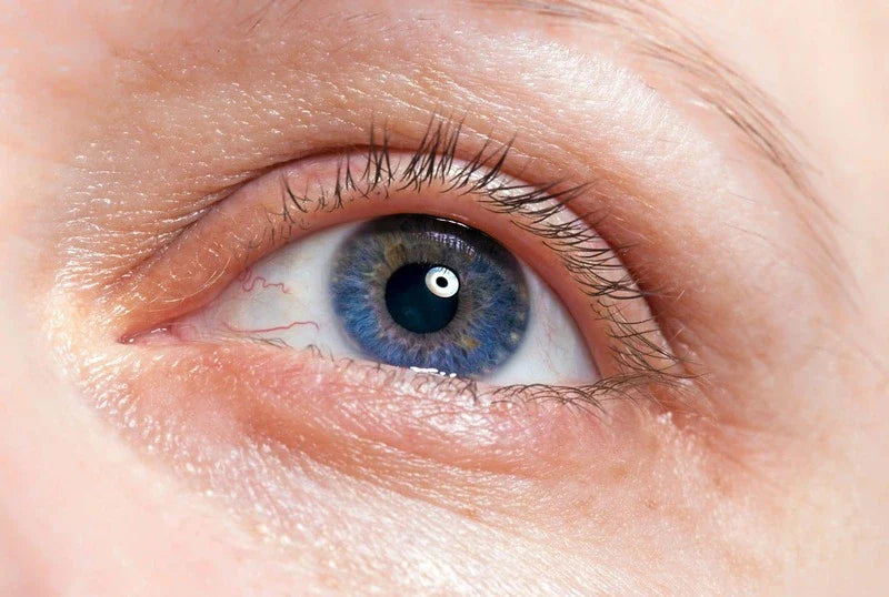 thinning eyelashes